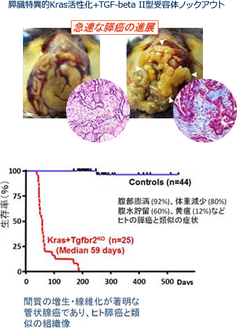 膵臓特異的Kras活性化＋TGF-beta II型受容体ノックアウト